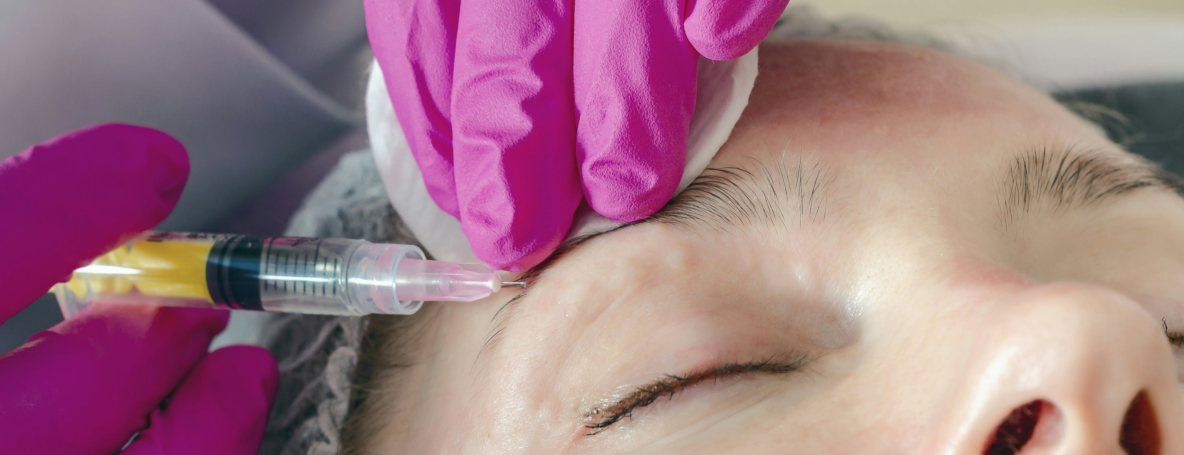 Collagen Injection Singapore: Do You Really Need It?